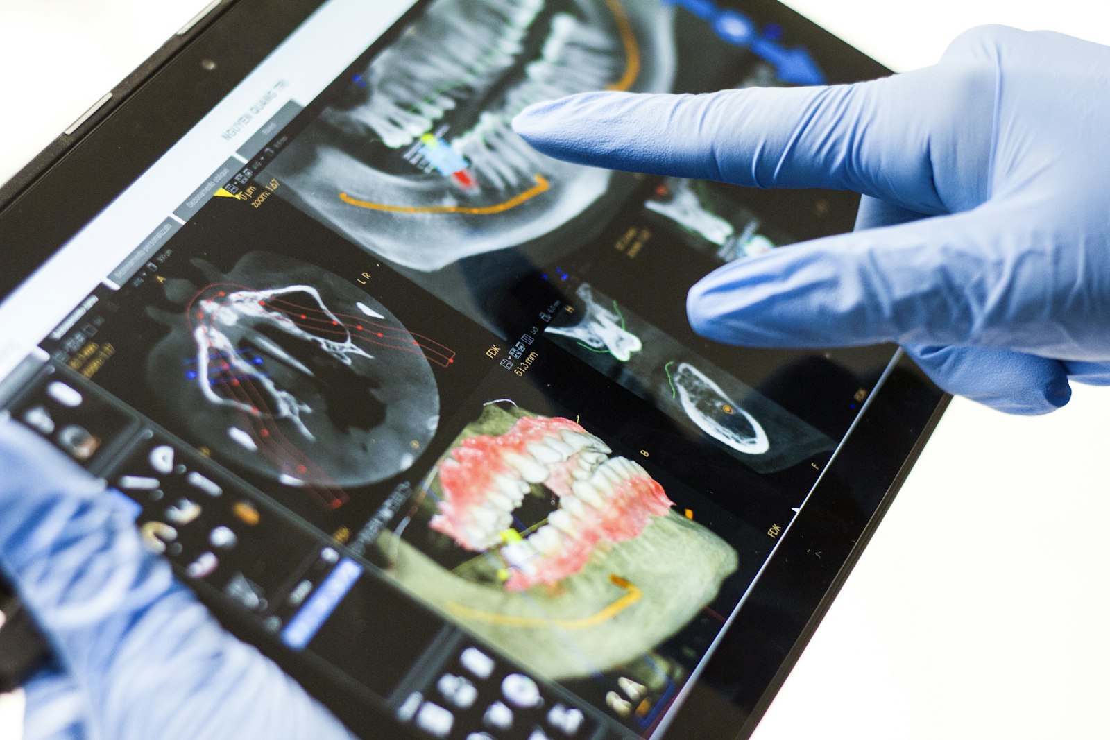 Reviewing a 3D dental scan together on a tablet