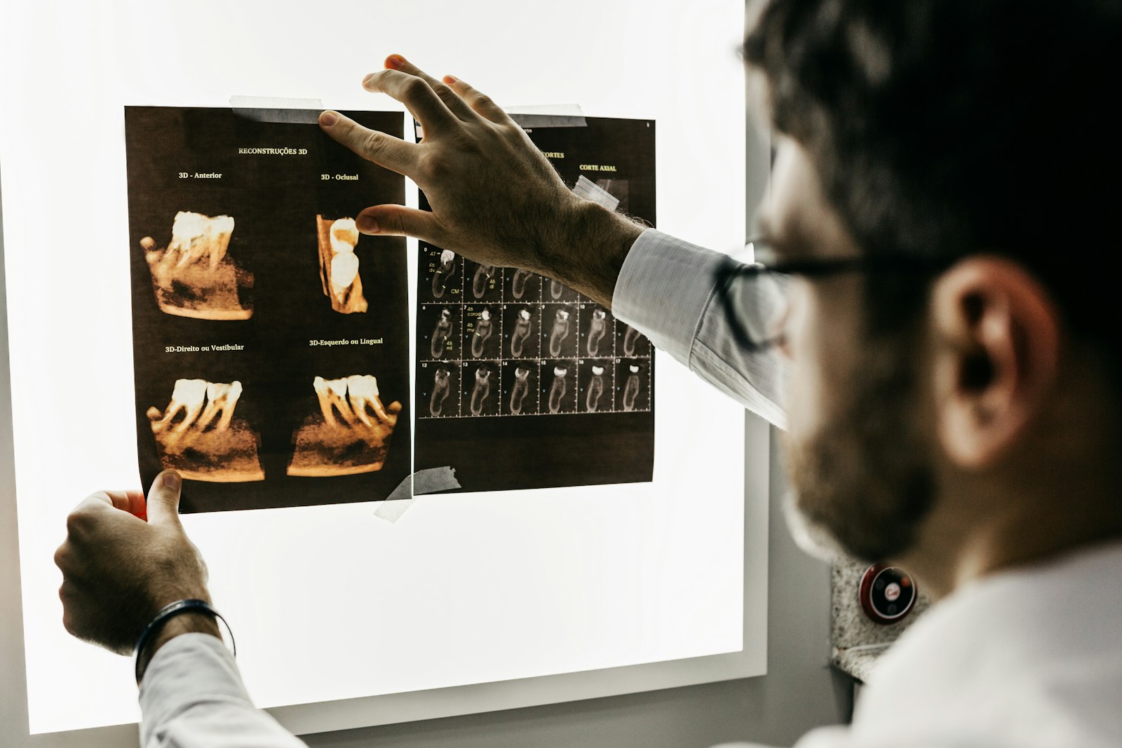 Digital X-ray review on a light board