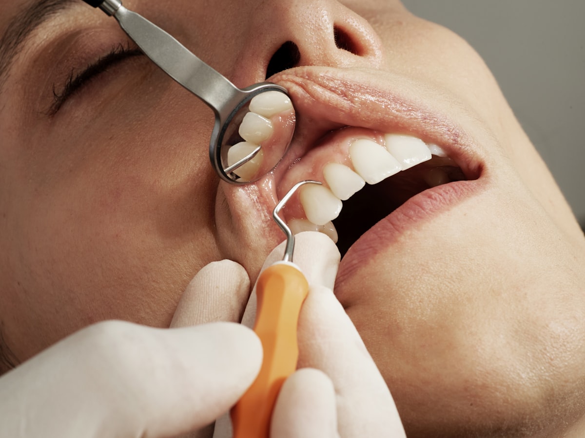 Root Canal Therapy