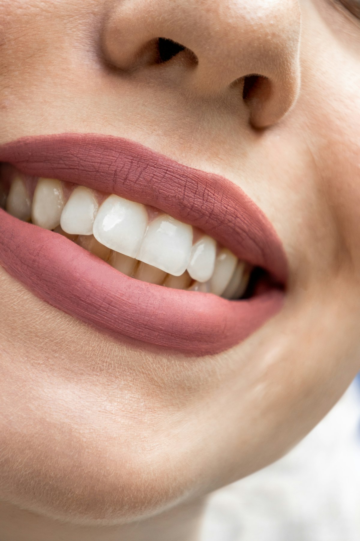 Smile after treatment